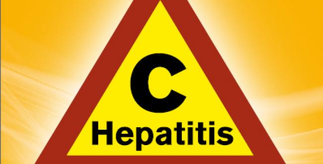 hepatitis C