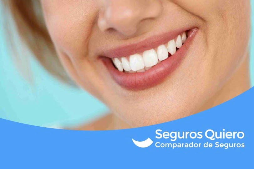 ¿Qué cubre un seguro dental? Tienes que saber esto.