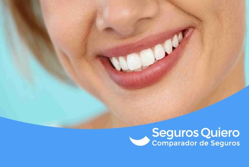 ¿Qué cubre un seguro dental? Tienes que saber esto.